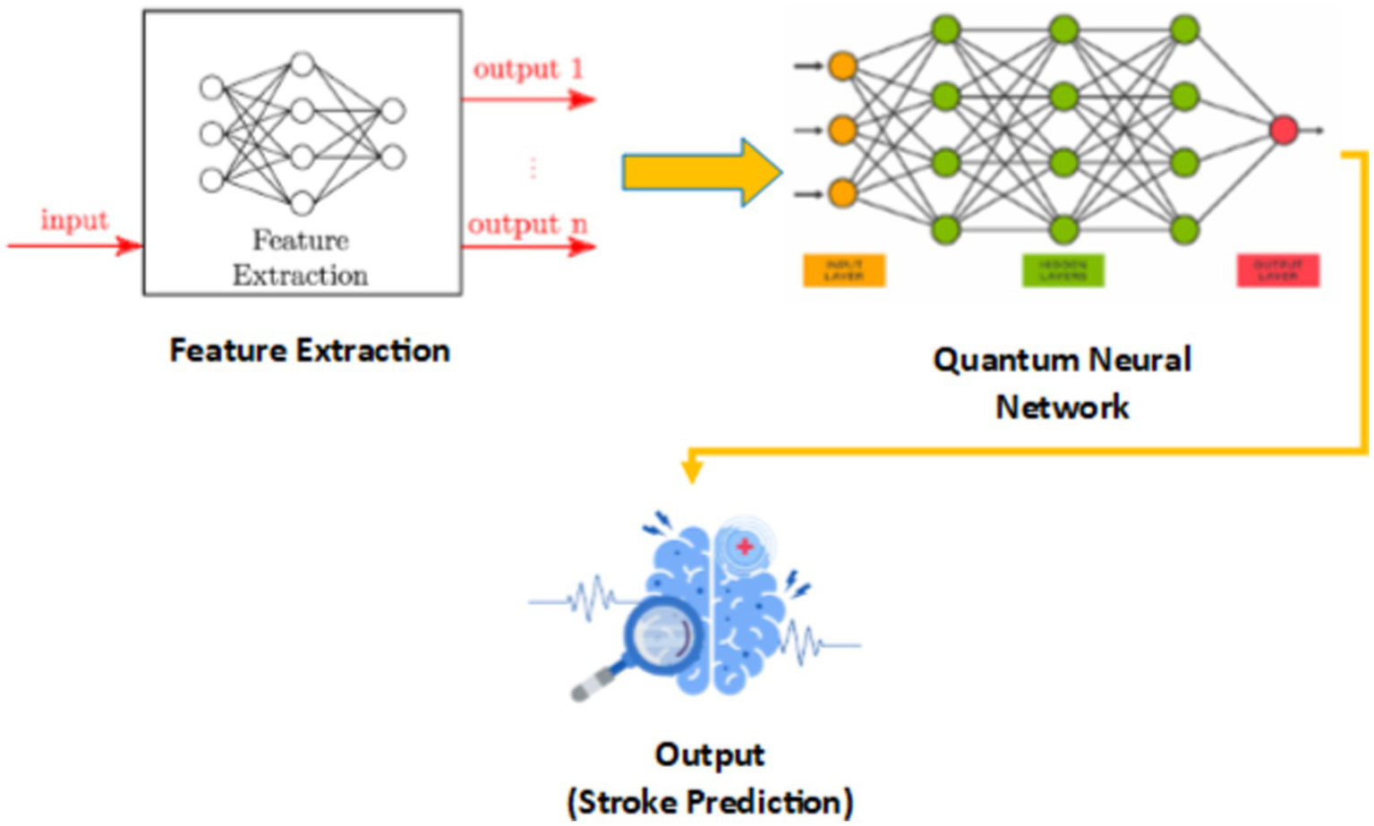 Diagram illustrating a process flow for stroke prediction using a quantum neural network. It begins with feature extraction, where input data is processed to produce multiple outputs. These outputs are fed into a quantum neural network, depicted with input, hidden, and output layers. The final output is a prediction for stroke, symbolized by a brain and magnifying glass.