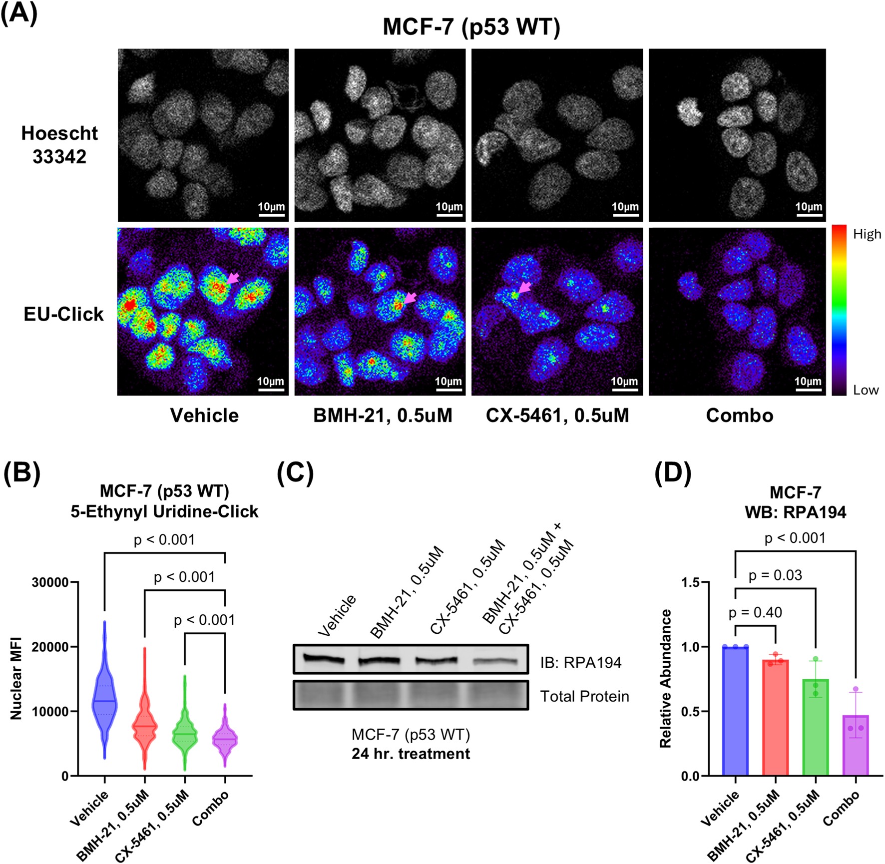 (A) Confocal microscopy images of MCF-7 cells treated with Vehicle, BMH-21, CX-5461, and combo, stained with Hoechst 33342 and EU-Click, showing varying fluorescence intensities. (B) Violin plot displaying nuclear MFI of 5-ethynyl uridine-click in treated cells, indicating significant decreases. (C) Western blot analysis for RPA194 in treated cells with total protein loading control, indicating protein expression changes. (D) Bar graph showing relative RPA194 abundance, with statistical significance indicated by p-values. Treatments include Vehicle, BMH-21, CX-5461, and their combination.