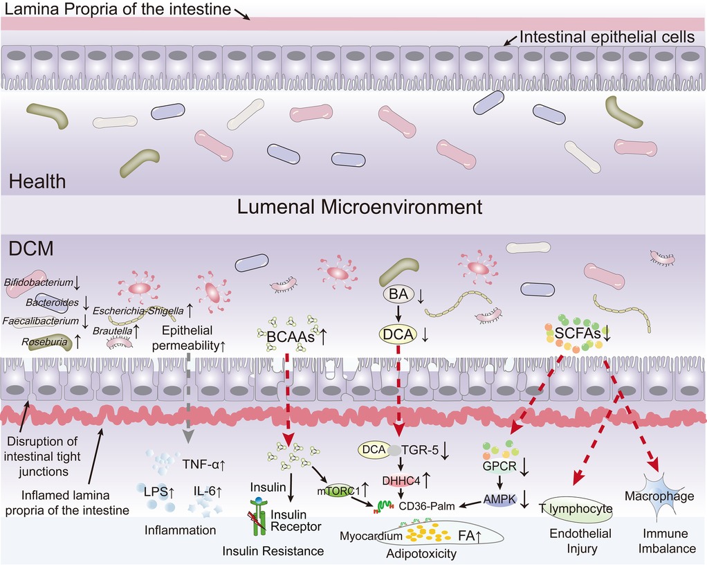 Illustration showing intestinal microenvironment differences between health and disease conditions. The top half depicts healthy bacteria and structures. The bottom half shows disease-associated changes like increased pathogenic bacteria, disrupted intestinal integrity, and inflammation. Arrows indicate interactions like increased bacterial counts, epithelial permeability, and pathways leading to insulin resistance, myocardial adipotoxicity, endothelial injury, and immune imbalance. Key terms include BCAAs, SCFAs, DCA, and BA.