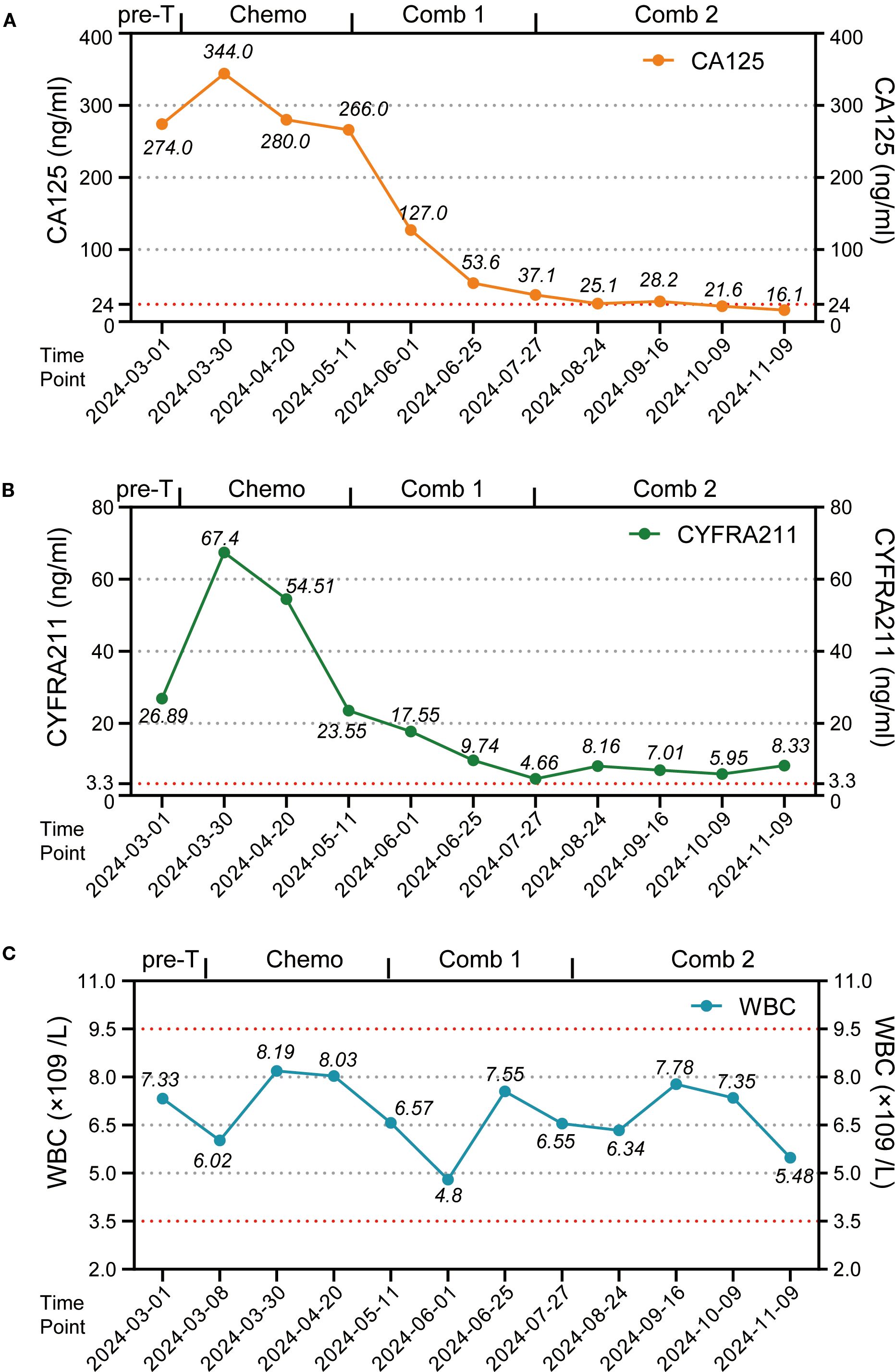 Three line graphs show levels of CA125, CYFRA211, and WBC over time with different treatments. Graph A displays a decrease in CA125 from 344.0 ng/ml in March 2024 to 16.1 ng/ml in November 2024 across pre-treatment, chemotherapy, and two combination therapies. Graph B shows CYFRA211 peaking at 67.4 ng/ml in March 2024 with a decline to 8.33 ng/ml in November 2024. Graph C illustrates fluctuations in WBC, holding mostly steady, ending at 5.48 × 10^9/L in November 2024.