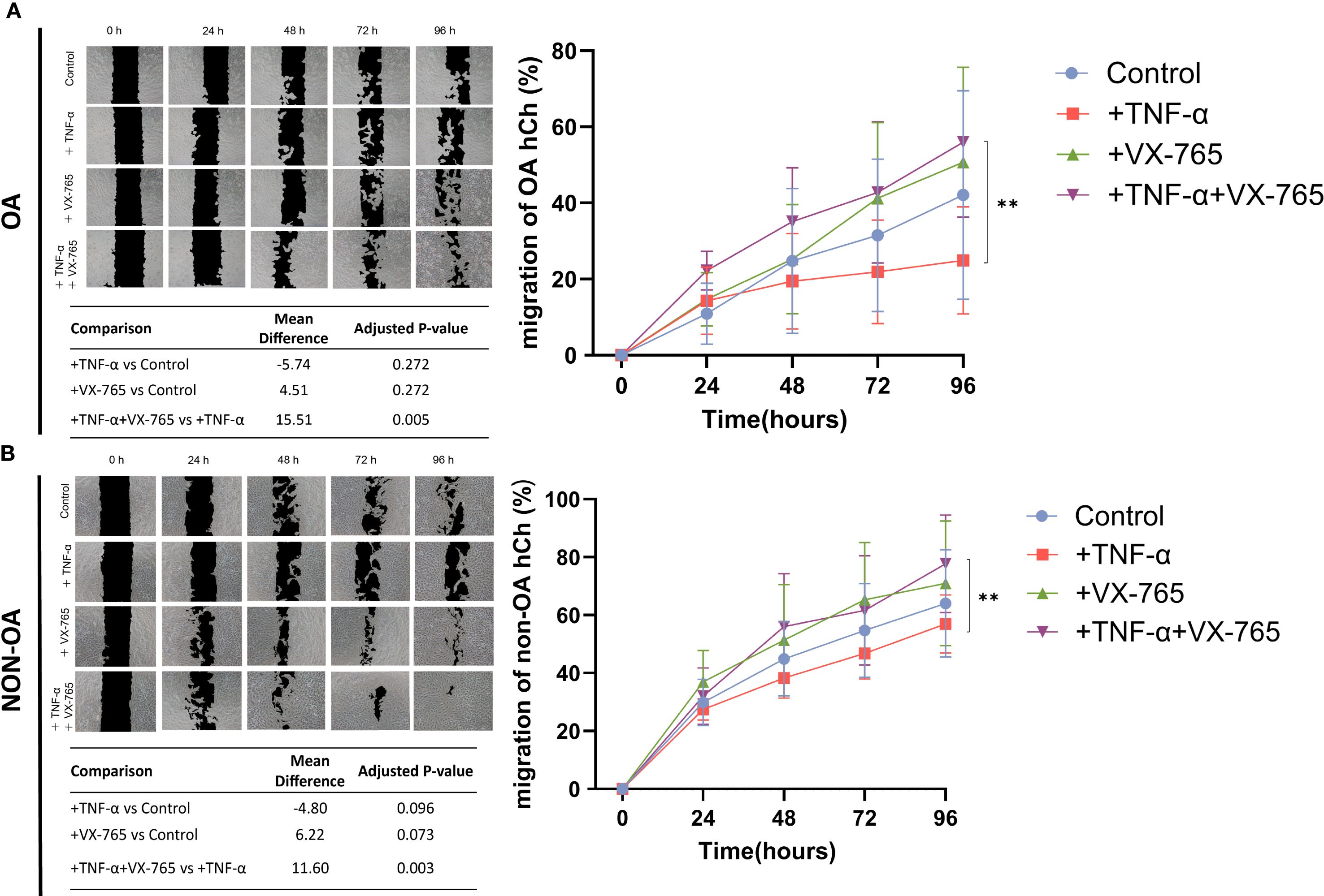 Research image showing the effects of different treatments on cell migration over time. The left panels display wound healing assays at various time points (0 to 96 hours) with different treatments: Control, TNF-α, VX-765, and TNF-α plus VX-765 for OA and non-OA conditions. The right panels show line graphs representing the percentage of cell migration, with legend detailing the treatments. Statistical tables indicate mean differences and adjusted P-values, highlighting significant differences for the combined treatment.