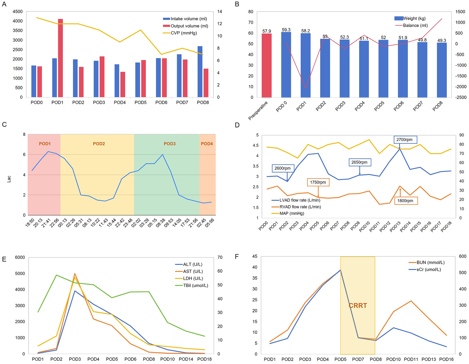 Six graphs present various medical data trends across postoperative days (PODs):\n\nA: Bar and line chart showing intake and output volumes in milliliters and central venous pressure in millimeters of mercury from POD0 to POD8.\n\nB: Bar and line chart illustrating weight in kilograms and fluid balance in milliliters from preoperative to POD8.\n\nC: Line chart of lactate levels measured at intervals across POD1 to POD4.\n\nD: Line chart for LVAD and RVAD flow rates in liters per minute and mean arterial pressure from POD0 to POD18.\n\nE: Line chart depicting levels of ALT, AST, LDH, and TBI from POD1 to POD18.\n\nF: Line chart for BUN and serum creatinine levels from POD1 to POD16, highlighting CRRT intervention between POD5 and POD8.