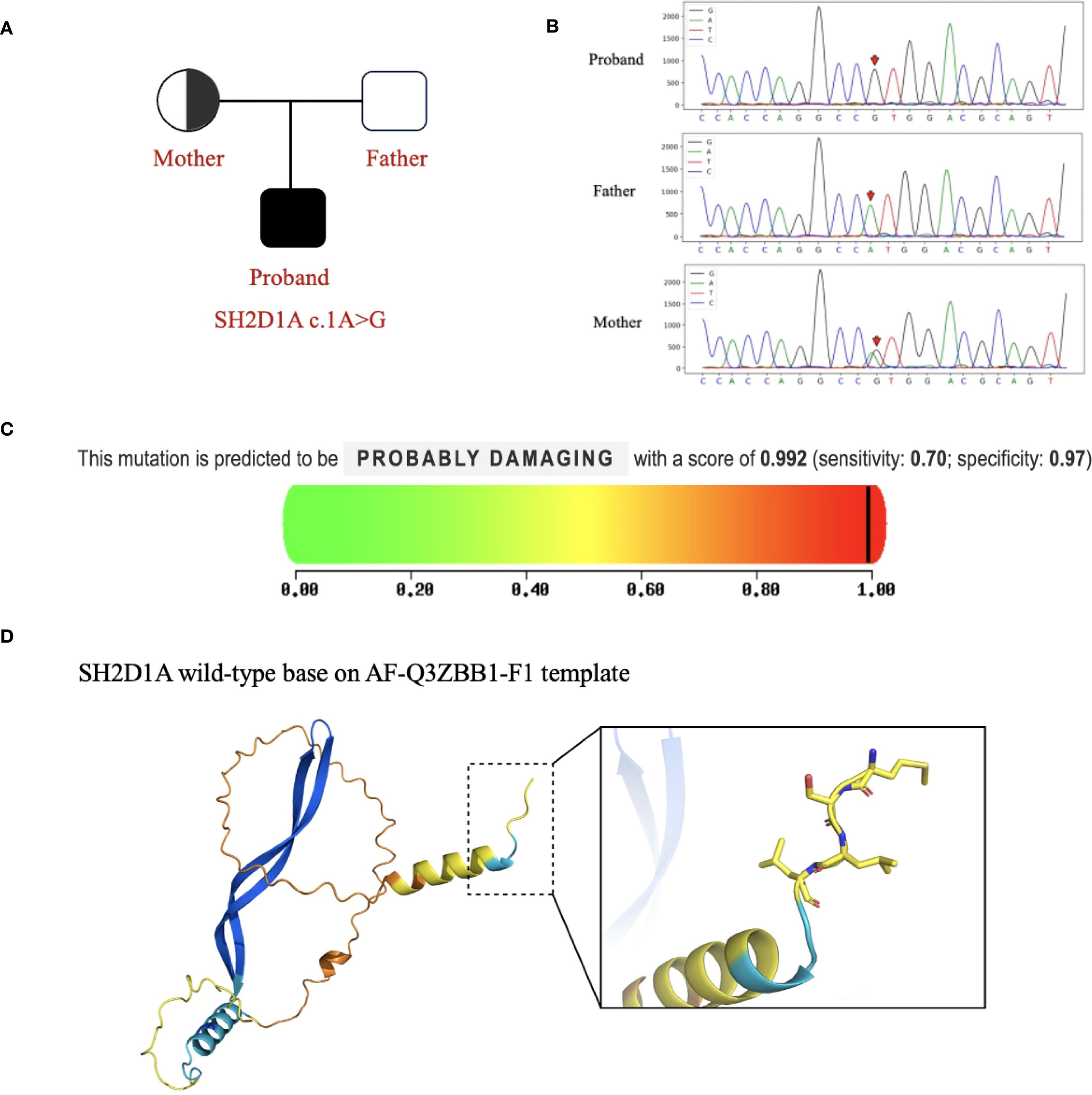 Diagram of genetic analysis showing four panels. A: Pedigree chart with mother, father, and proband, highlighting SH2D1A c.1A>G mutation. B: Sanger sequencing traces for proband, father, and mother, with mutation indicated by red symbols. C: Bar indicating mutation is “probably damaging” with a score of 0.992, sensitivity of 0.70, and specificity of 0.97. D: Protein model of SH2D1A wild-type with inset detail, based on AF-Q3ZBB1-F1 template.