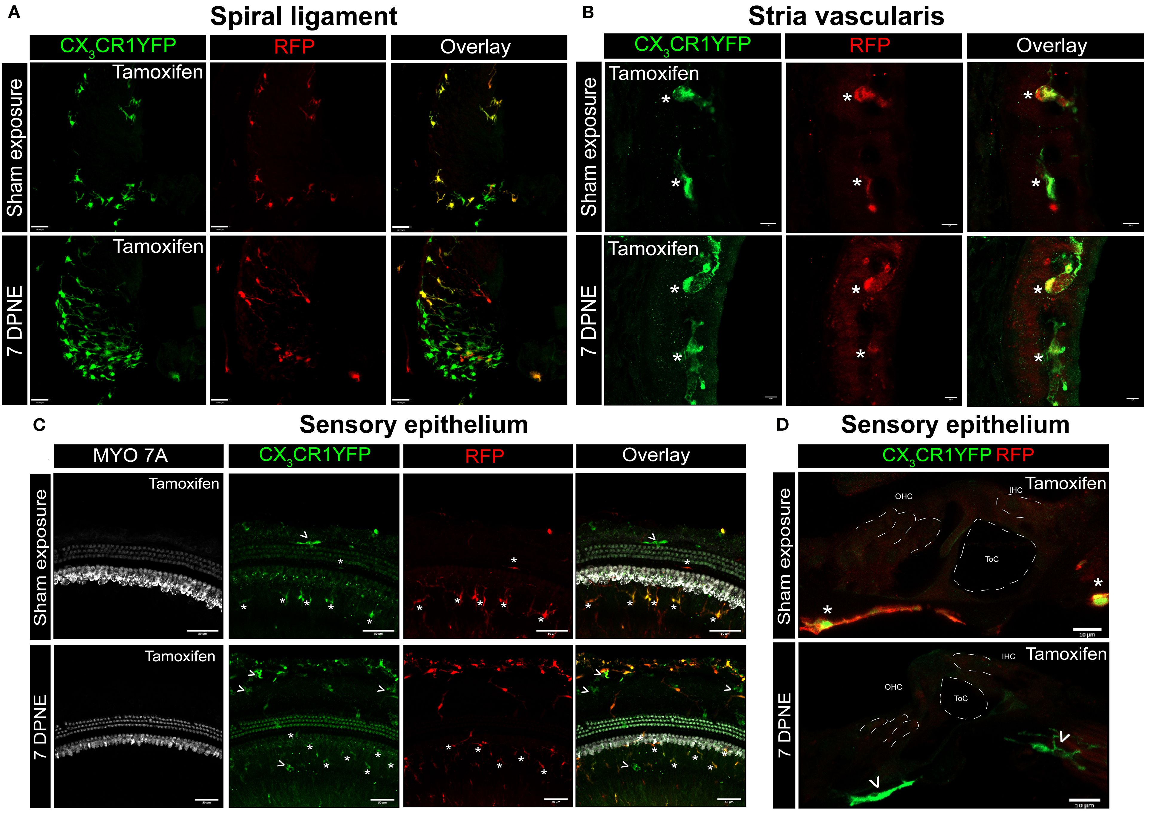 CX3CR1-expressing resident macrophages (RM) and monocytes and monocyte-derived macrophages (Mo/Mo-M) in the spiral ligament, stria vascularis, and sensory epithelium of the cochlea after acoustic trauma. Representative confocal images of the spiral ligament (A), stria vascularis (B), and sensory epithelium (C, D) from tamoxifen-injected Cre mice after sham exposure (top) and at 7 days after acoustic trauma (bottom). White asterisks show YFP+ RFP+ resident macrophages (yellow overlay), and white arrows show YFP+ RFP− recruited monocyte/monocyte-derived macrophages (green overlay). Mo/Mo-M (green) are present in the lower spiral ligament as the primary site for macrophage accumulation (A) and around the sensory epithelium (D), but not in the stria vascularis (B) of the noise-injured cochlea. Scale bars = 30 μm (A), 5 μm (B), 50 μm(C), and 10 μm (D).