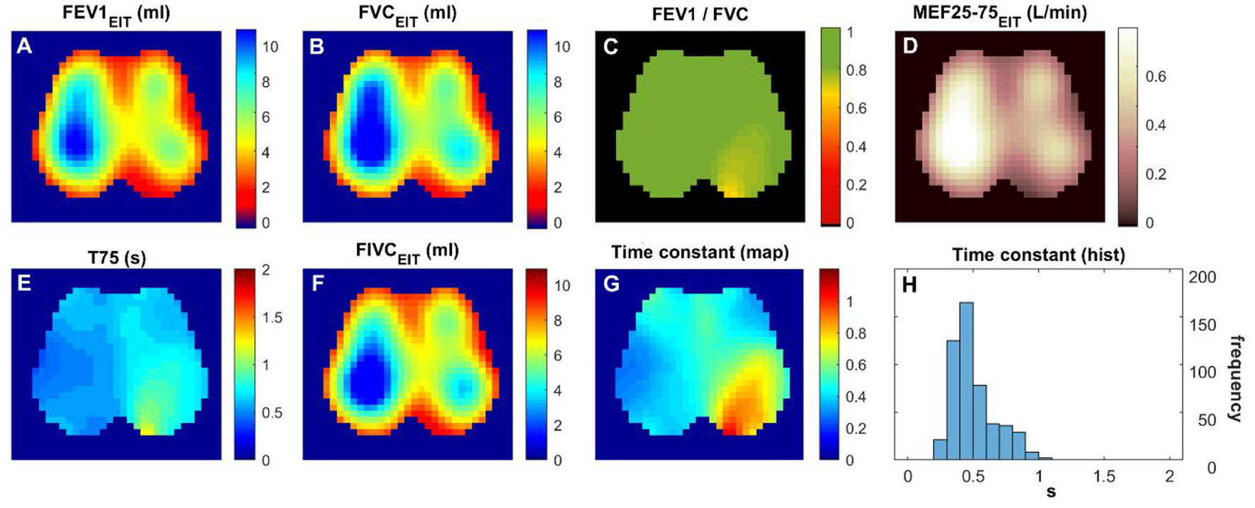 Seven colored heatmaps and one histogram display respiratory metrics using Electrical Impedance Tomography (EIT). The maps labeled A to G show FEV1, FVC, FEV1/FVC ratio, MEF25-75, T75, and FIVC with varied color scales indicating different values. The histogram, labeled H, depicts the distribution of time constants on the x-axis and frequency on the y-axis.