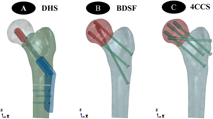 Illustration showing three hip fixation techniques. Panel A illustrates DHS with a single large screw and side plate. Panel B displays BDSF with multiple angled screws. Panel C shows 4CCS with four parallel screws. Each panel includes a coordinate axis.