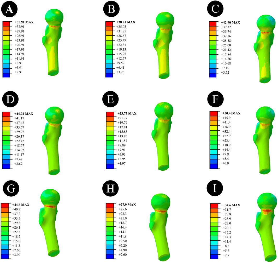 Nine panels labeled A to I, each displaying a color-coded 3D model of a bone structure with different stress levels. Each panel has a scale showing stress values from low (blue) to high (red) in megapascals (MPa), with a maximum value noted for each. The bone models primarily appear in shades of green and yellow, indicating moderate stress levels.