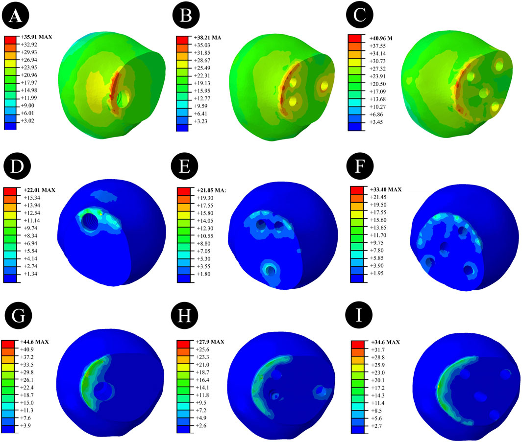 Nine spherical 3D models with color-coded stress distribution maps labeled A to I. Each model displays varying levels of stress using a spectrum from blue (low) to red (high). Models A, B, and C show higher stress concentrations compared to the others. Each model includes a corresponding color scale indicating stress values.