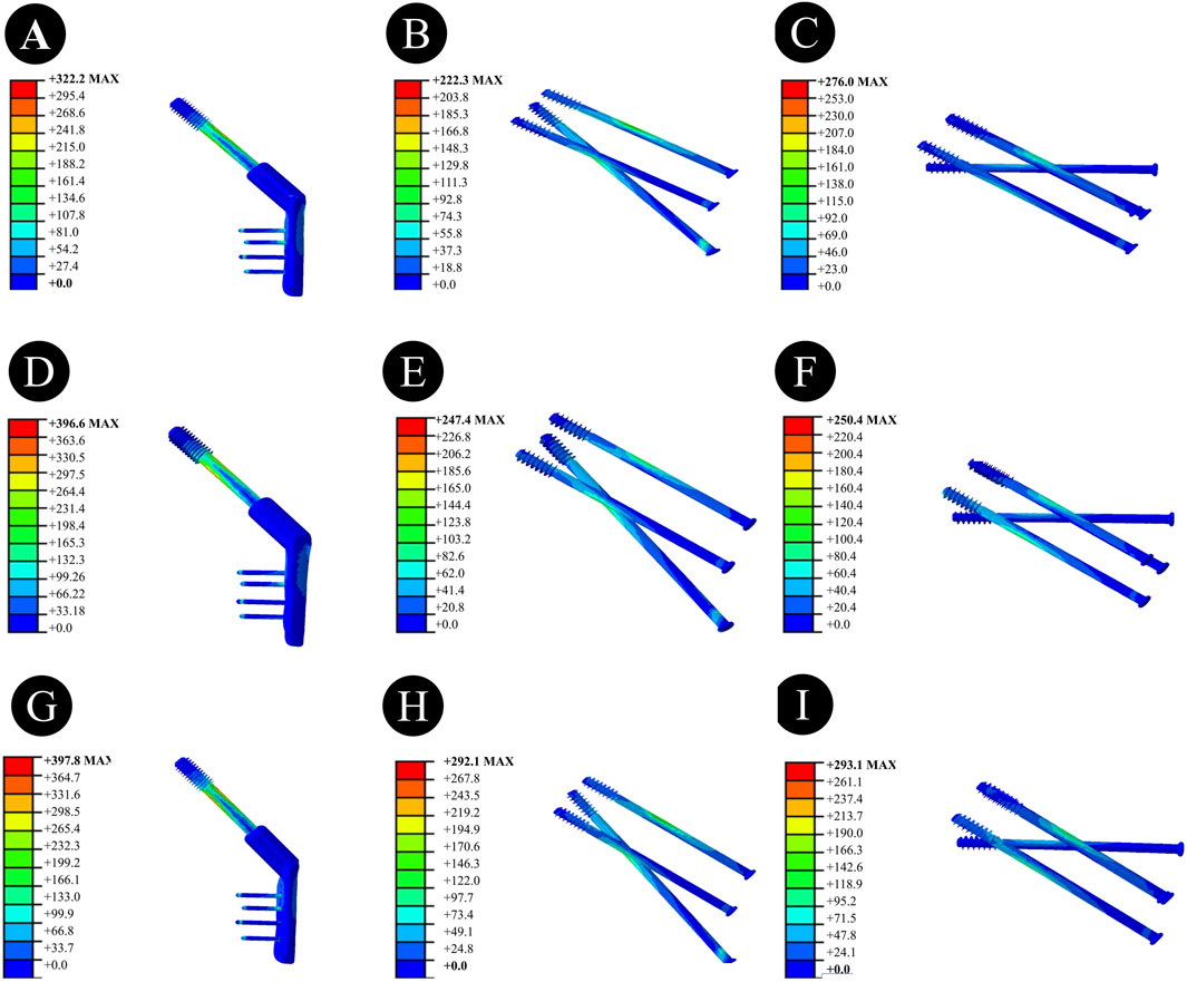 FEA results of different screw models under various conditions, labeled A to I. Each model is accompanied by a color scale indicating stress from blue (low) to red (high). Models A, D, and G show bent configurations, while B, C, E, F, H, and I depict linear configurations with variations in stress distribution.