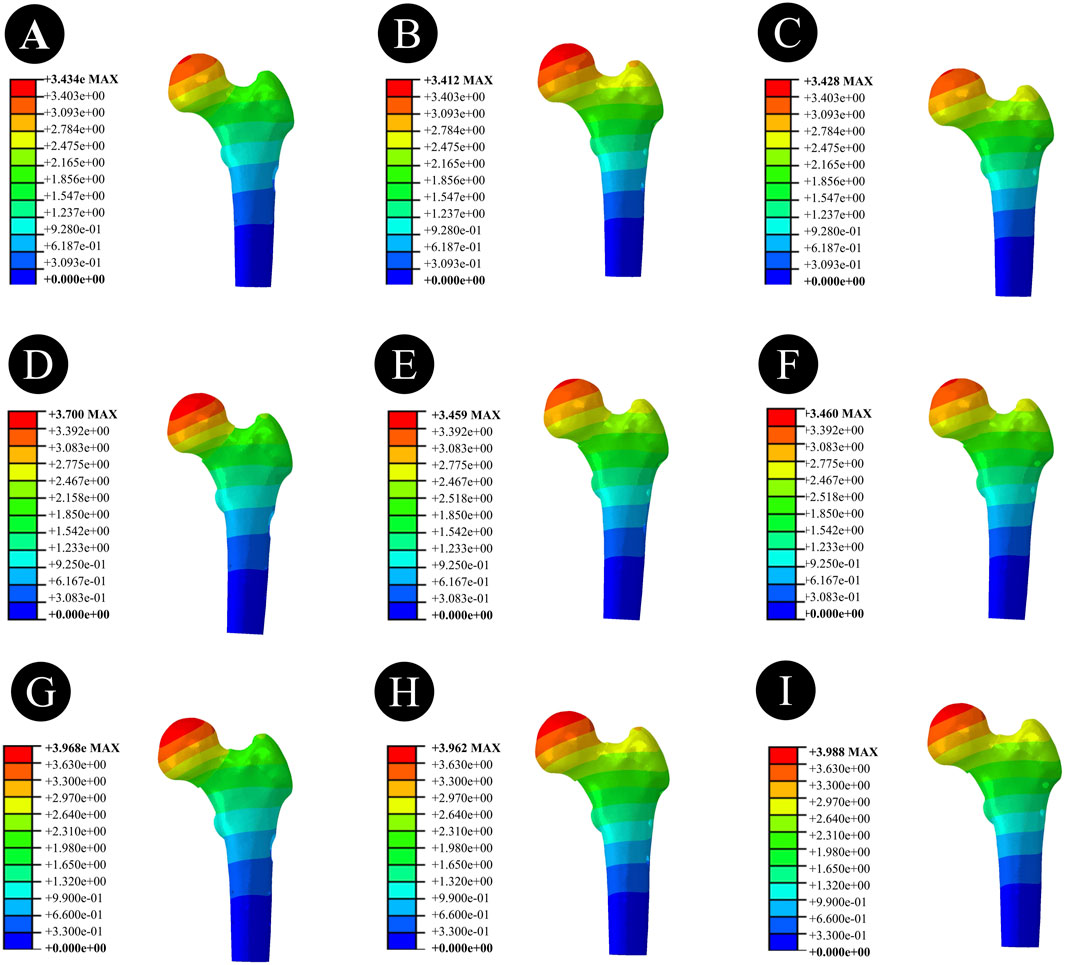Nine color-coded diagrams labeled A to I, each depicting a femur with a stress distribution scale. Colors range from red, indicating maximum stress, to blue, indicating minimum stress. Each image includes a numerical stress scale beside the femur.