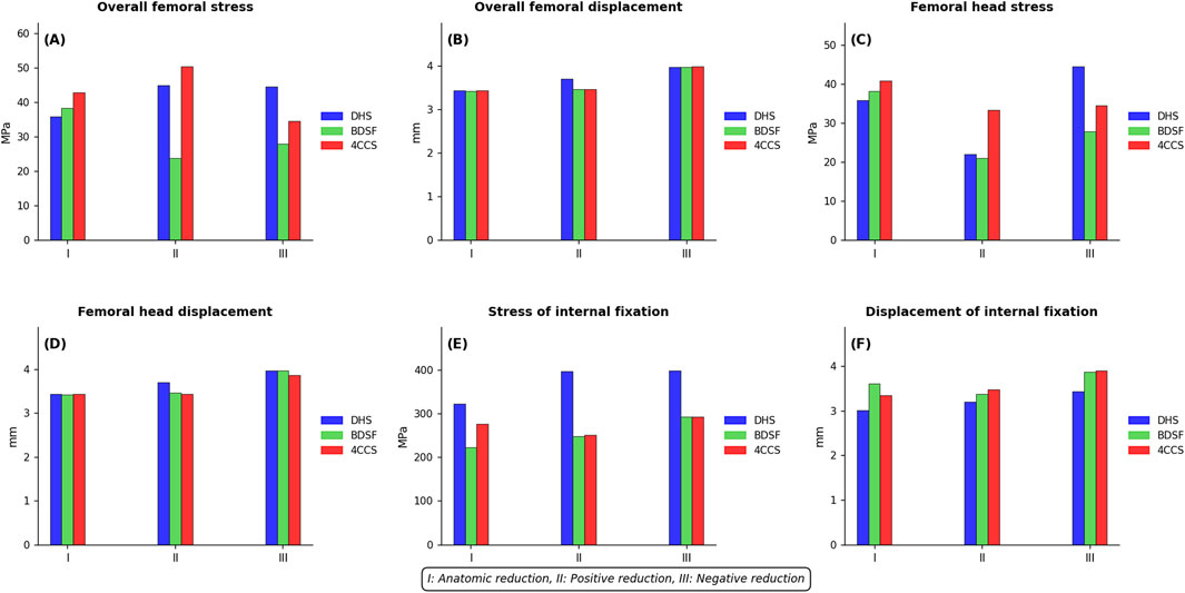 Bar charts displaying various stress and displacement metrics related to femoral analysis under three conditions: I (anatomic reduction), II (positive reduction), and III (negative reduction). Six diagrams show overall femoral stress, displacement, femoral head stress, displacement, internal fixation stress, and displacement, comparing DHS, BDSF, and 4CCS systems in different colors. Each chart reveals variations in results based on the type of reduction method used.
