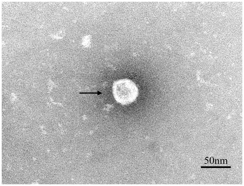Electron microscope image depicting a virus particle highlighted with an arrow. The virus appears as a bright circular shape against a textured gray background. A scale bar indicates fifty nanometers.