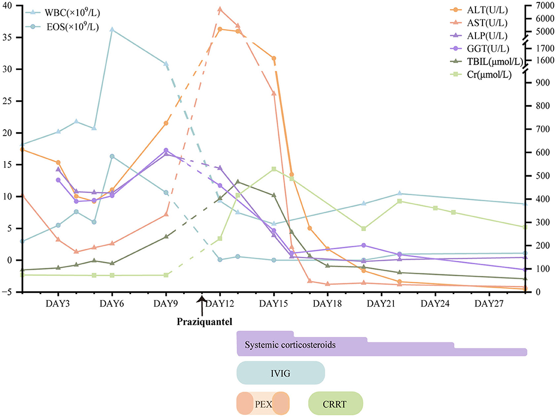 Line graph showing changes in blood test results over 27 days and the timing of Praziquantel administration on day 12. Key indicators include WBC, EOS, ALT, AST, ALP, GGT, TBIL, and Cr. Various treatments like systemic corticosteroids, IVIG, PEX, and CRRT are marked on a timeline below the graph. The graph highlights a peak and subsequent drop in several indicators following Praziquantel and treatment interventions.