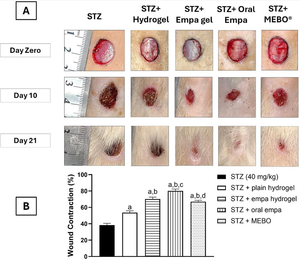 Panel A shows images of wound healing over 21 days, comparing different treatments: STZ, STZ with Hydrogel, STZ with Empa gel, STZ with Oral Empa, and STZ with MEBO. Panel B is a bar graph displaying wound contraction percentages for each treatment. Treatments with hydrogel, Empa gel, and MEBO show better healing compared to STZ alone.