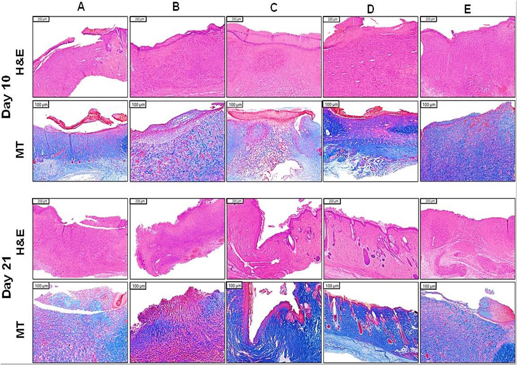 Histological slide comparison of tissue samples at Day 10 and Day 21 with H&E and Masson's Trichrome staining across columns A to E. The upper rows for each day show H&E stain with pink and purple hues, while the lower rows depict Masson's Trichrome stain highlighting collagen in blue. Each column represents different sample conditions or treatments labeled A to E, with scale bars indicating magnification levels.