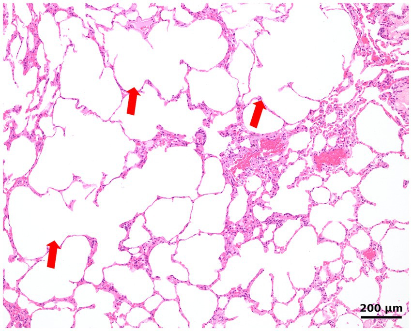 Microscopic image of lung tissue showing alveolar sacs separated by thin, pink-stained septa. Three red arrows highlight areas of interest, likely depicting structural features or abnormalities. The scale bar indicates two hundred micrometers.