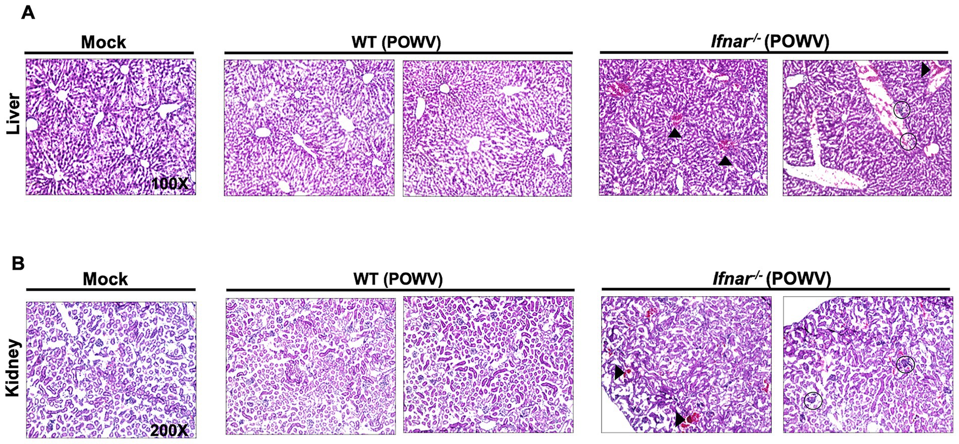 Histological slides show liver and kidney tissues stained with hematoxylin and eosin. Panel A depicts liver sections: mock, WT (POWV), and Ifnar-/- (POWV) with notable cellular differences. Panel B shows kidney sections with similar classifications, highlighting structural variances. Arrowheads and circles indicate specific features in Ifnar-/- (POWV) sections. Magnifications are 100X for liver and 200X for kidney.