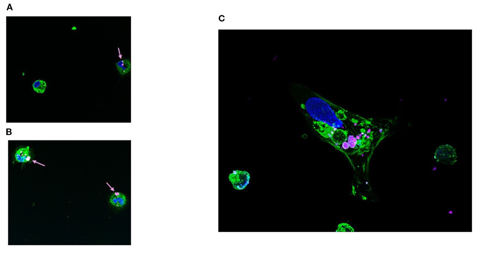 Fluorescent microscopy images of cells. Panel A shows several round cells with green cytoplasm and blue nuclei, highlighted by arrows. Panel B shows similar features with arrows pointing to specific cellular components. Panel C displays a larger cell with a vivid green cytoplasm and prominent blue nucleus, accompanied by small pink structures within the cell.