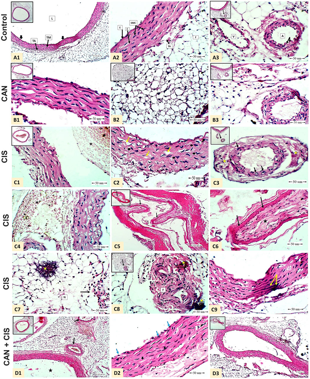 Histological images showing various tissue samples with annotations, including labeled components like layers, cells, and structures. Each panel (A, B, C, and D) represents different conditions: Control (A1-A3), CAN (candesartan; B1-B3), CIS (cisplatin; C1-C9), and CAN+CIS (D1-D3). Insets highlight detailed views, and scale bars indicate size.