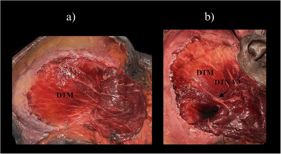 Panel a displays a close-up of muscle tissue labeled \