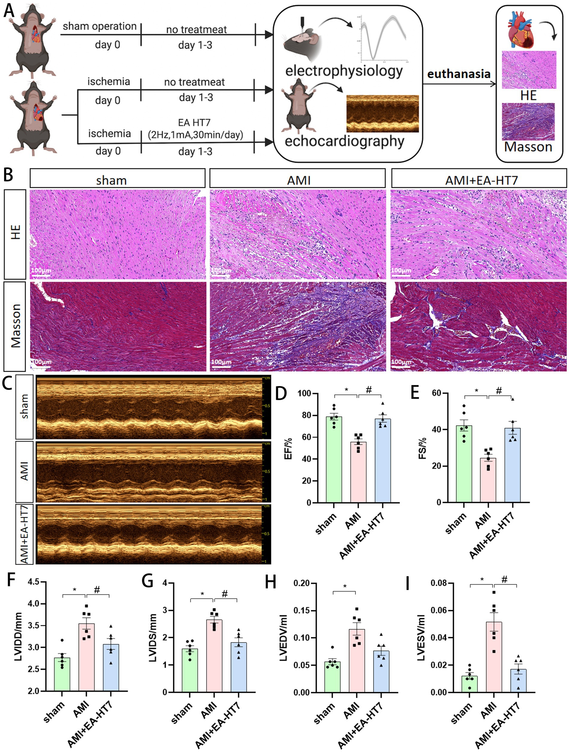 A scientific diagram illustrating experimental procedures and results for a study involving rats and cardiac ischemia. Panel A shows a flowchart detailing procedures for sham operation and ischemia with and without EA HT7 treatment, followed by electrophysiology, echocardiography, and euthanasia. Panel B includes histological images with HE and Masson's trichrome staining for sham, AMI, and AMI plus EA-HT7 groups. Panel C displays echocardiographic images for each group. Panels D to I present bar graphs comparing various cardiac function metrics across groups, indicating significant differences.