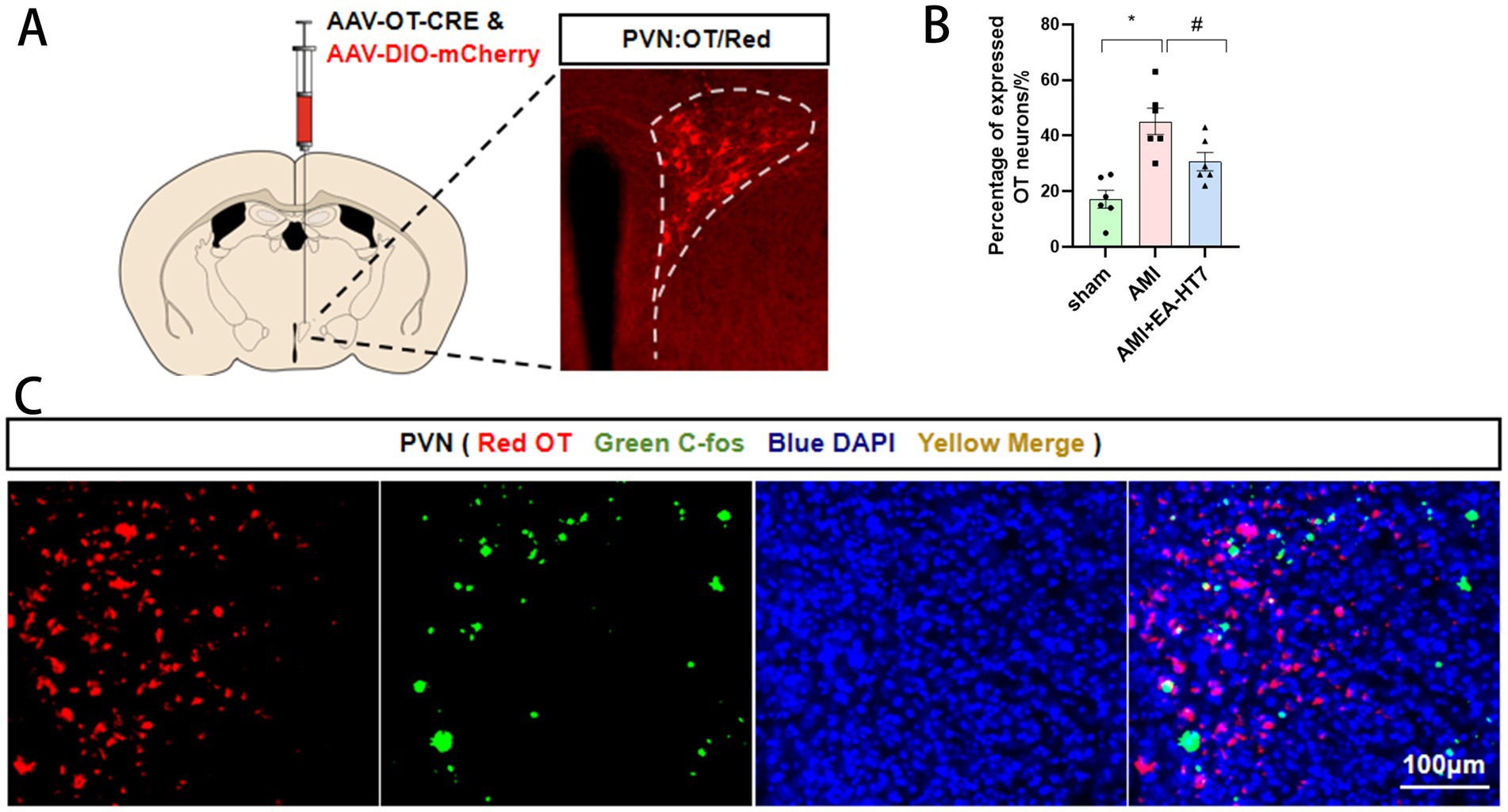 Diagram and results of a neuroscience experiment. Panel A shows an injection diagram targeting PVN in a brain section, with a close-up of a stained region. Panel B presents a bar graph comparing the percentage of expressed OT neurons across three conditions: sham, AMI, and AMI+EA-HT7, with significant differences marked. Panel C features fluorescence microscopy images: red for OT, green for c-fos, blue for DAPI, and a merged image with arrows highlighting overlaps in expression. Scale bars indicate 100 micrometers.