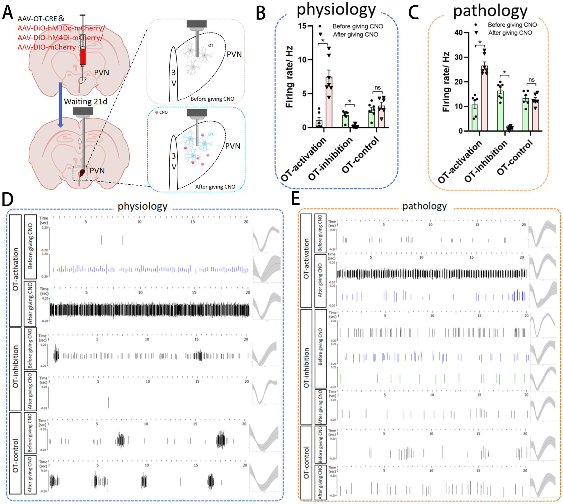 Diagram showing experiments involving AAV injections in the PVN and subsequent electrophysiological recordings before and after CNO treatment. Graphs B and C display firing rates under OT-activation, OT-inhibition, and OT-control conditions in physiology and pathology. Panels D and E illustrate detailed neural activity recordings during physiology and pathology, respectively, with time-aligned waveforms and histograms.