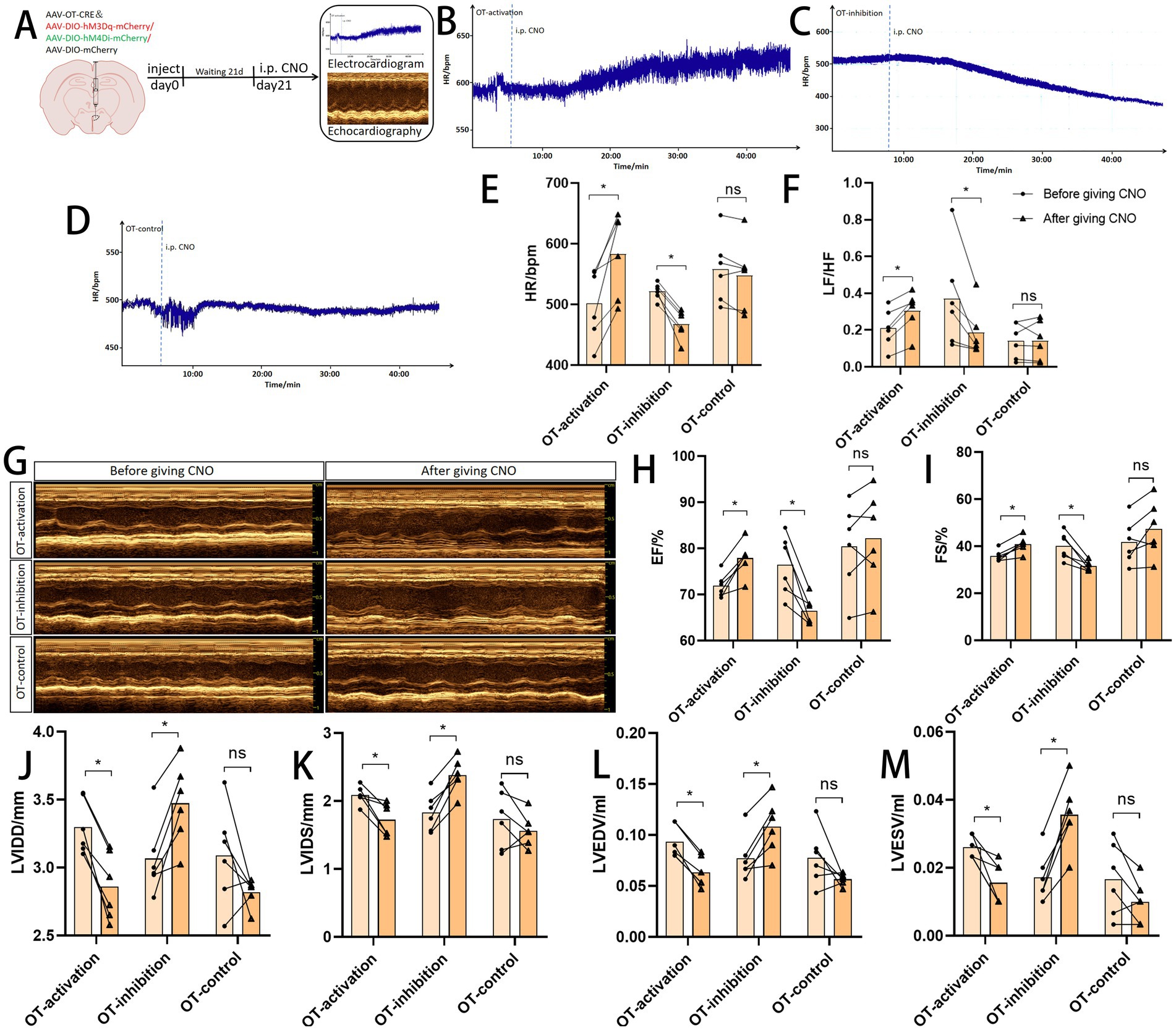 Research findings presented as graphs and charts investigating the effects of OT activation, inhibition, and control on heart function. Panel A describes the experimental design with a timeline and methods. Panels B through D show graphs of heart rate and measurements over time. Panels E to M display bar graphs comparing heart rate (HR), low-frequency/high-frequency (LF/HF) balance, ejection fraction (EF), fractional shortening (FS), and various cardiac dimensions before and after CNO administration. Statistical significance is indicated with asterisks, and ns denotes non-significant changes. Panel G includes echocardiography images before and after CNO treatment.