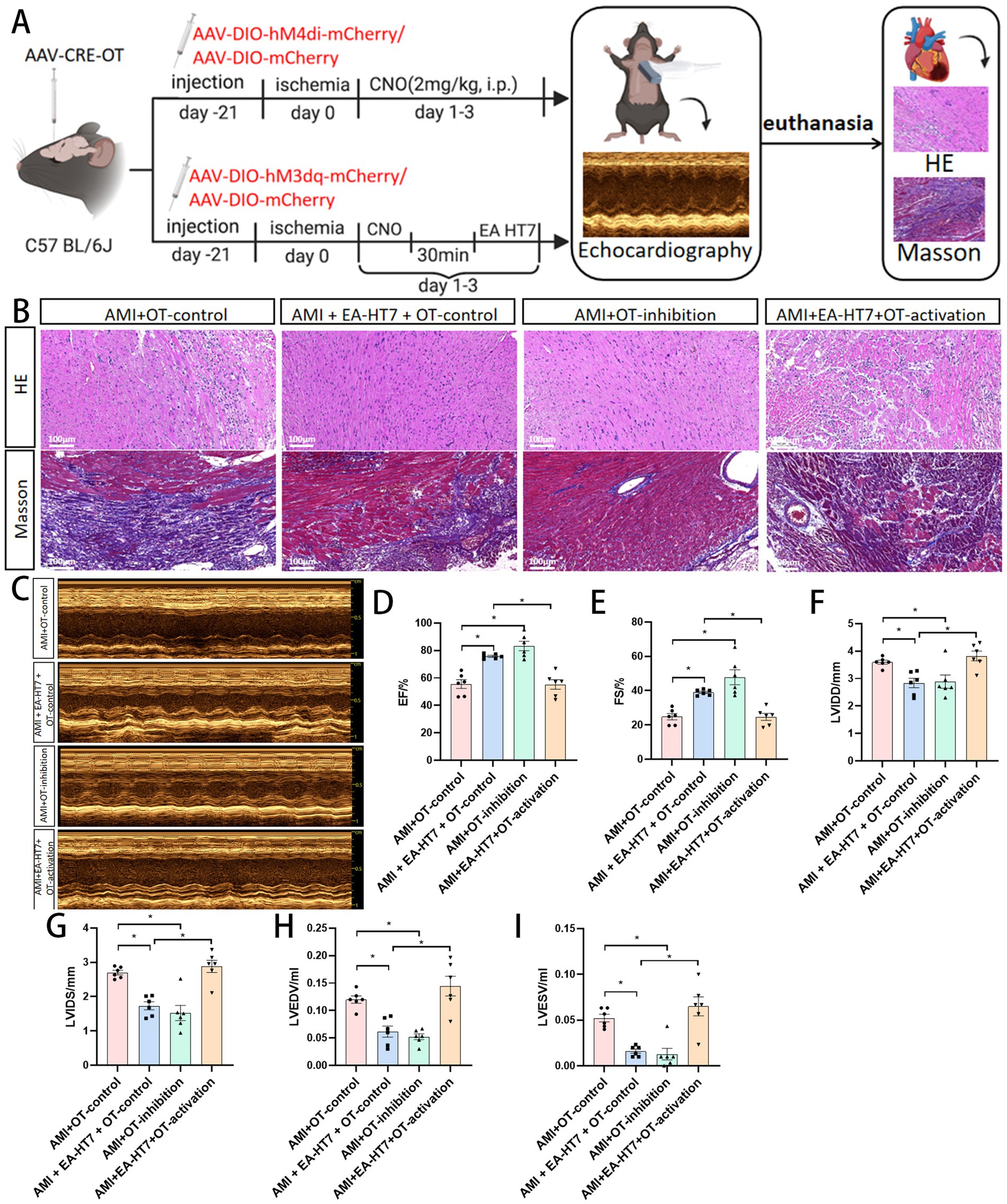 Schematic of a mouse study examining cardiac function with various treatments. Panel A shows the experimental timeline for gene injection, ischemia, and echocardiography. Panel B displays histological sections with H&E and Masson staining across four treatment groups. Panel C includes echocardiography images for heart function. Panels D to I present bar graphs of different cardiac measurements (EF%, FS%, LVDD, LVDS, LVEDV, LVESV) comparing treatment groups, with statistical significance indicated by asterisks.