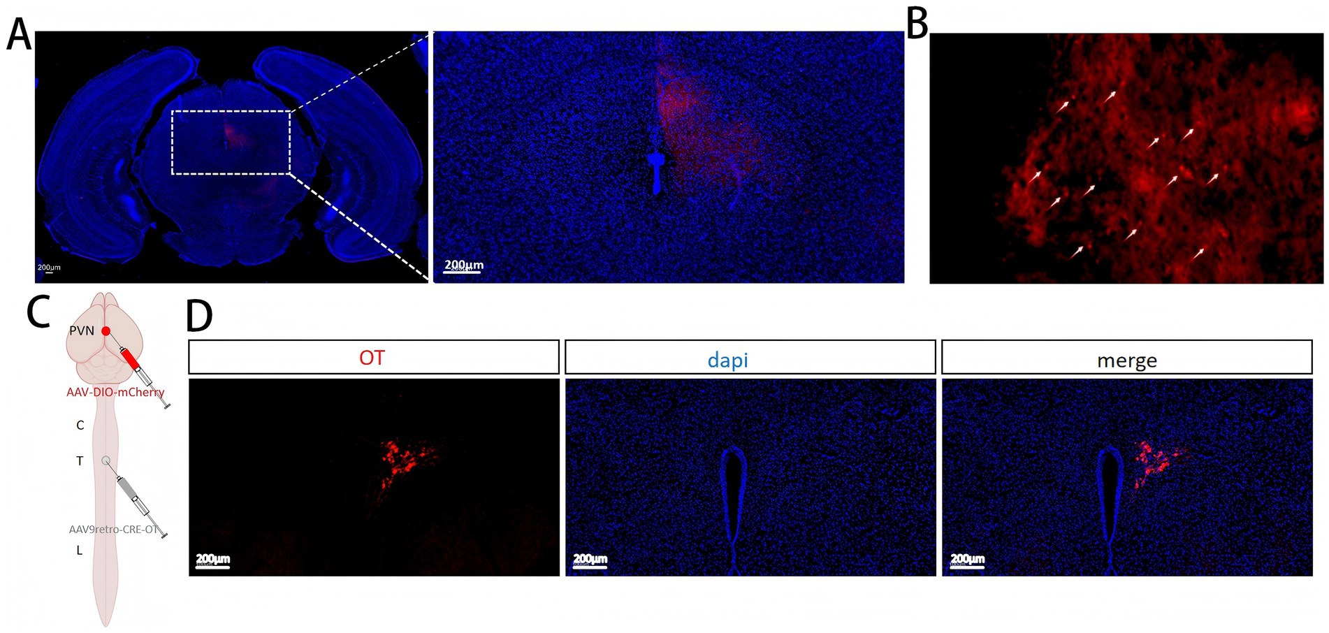 Composite image showing brain section analysis. Panel A displays a blue-stained brain slice with a highlighted square focusing on red markings. Panel B shows a zoomed-in view with arrows pointing to specific red areas. Panel C illustrates a diagram of a rodent brain, highlighting the injection site for AAV-DIO-mCherry. Panel D consists of three sub-images: red fluorescence (OT) highlighting a brain region, a blue-stained section (dapi), and a merged image combining both stains, illustrating cellular localization. Scale bars indicate 200 micrometers.