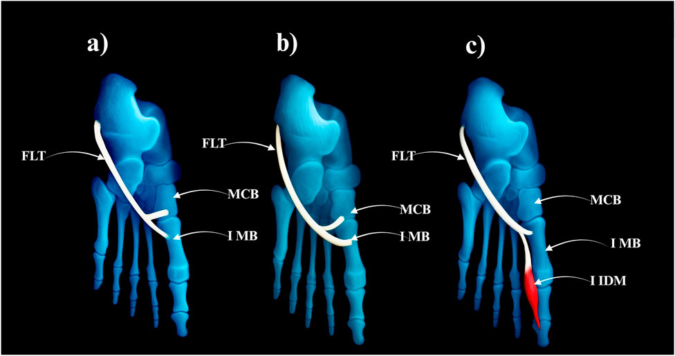Three 3D renderings of a foot model labeled a, b, and c on a black background. Each model depicts a foot with highlighted tendons and muscles. Labels indicate different parts: