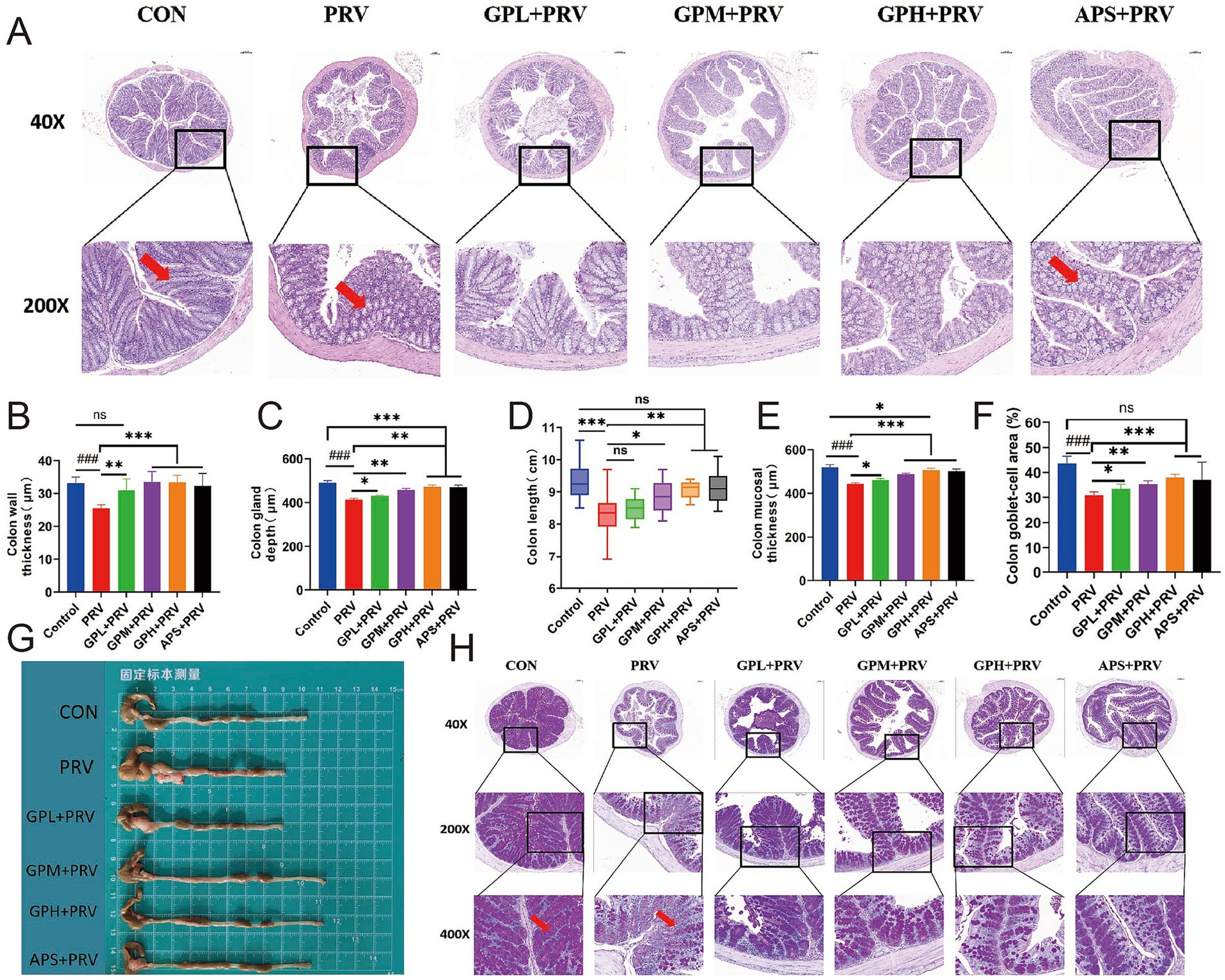Scientific figures displaying colon tissue histology and associated metrics. Panel A shows tissue sections from different treatment groups at 40X and 200X magnification, with arrows indicating notable features. Graphs B through F compare various colon parameter measurements, highlighting significant changes across groups. Panel G illustrates physical colon length across treatments. Panel H provides additional histological comparisons at different magnifications. Statistical significance is marked by asterisks, and
