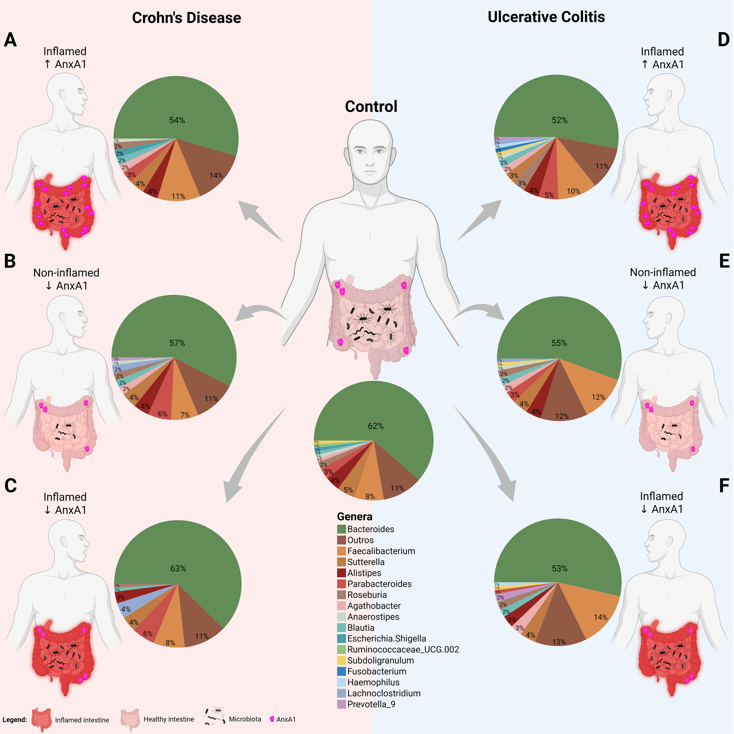 Diagram comparing intestinal microbiota composition and inflammation in Crohn's Disease, Ulcerative Colitis, and a Control. Panels A-F illustrate inflamed and non-inflamed states, each with pie charts showing bacterial genera proportions, such as Bacteroides and Faecalibacterium. Annotations indicate increased or decreased AnxA1 protein levels. The legend differentiates between inflamed and healthy intestines, microbiota, and AnxA1 presence.