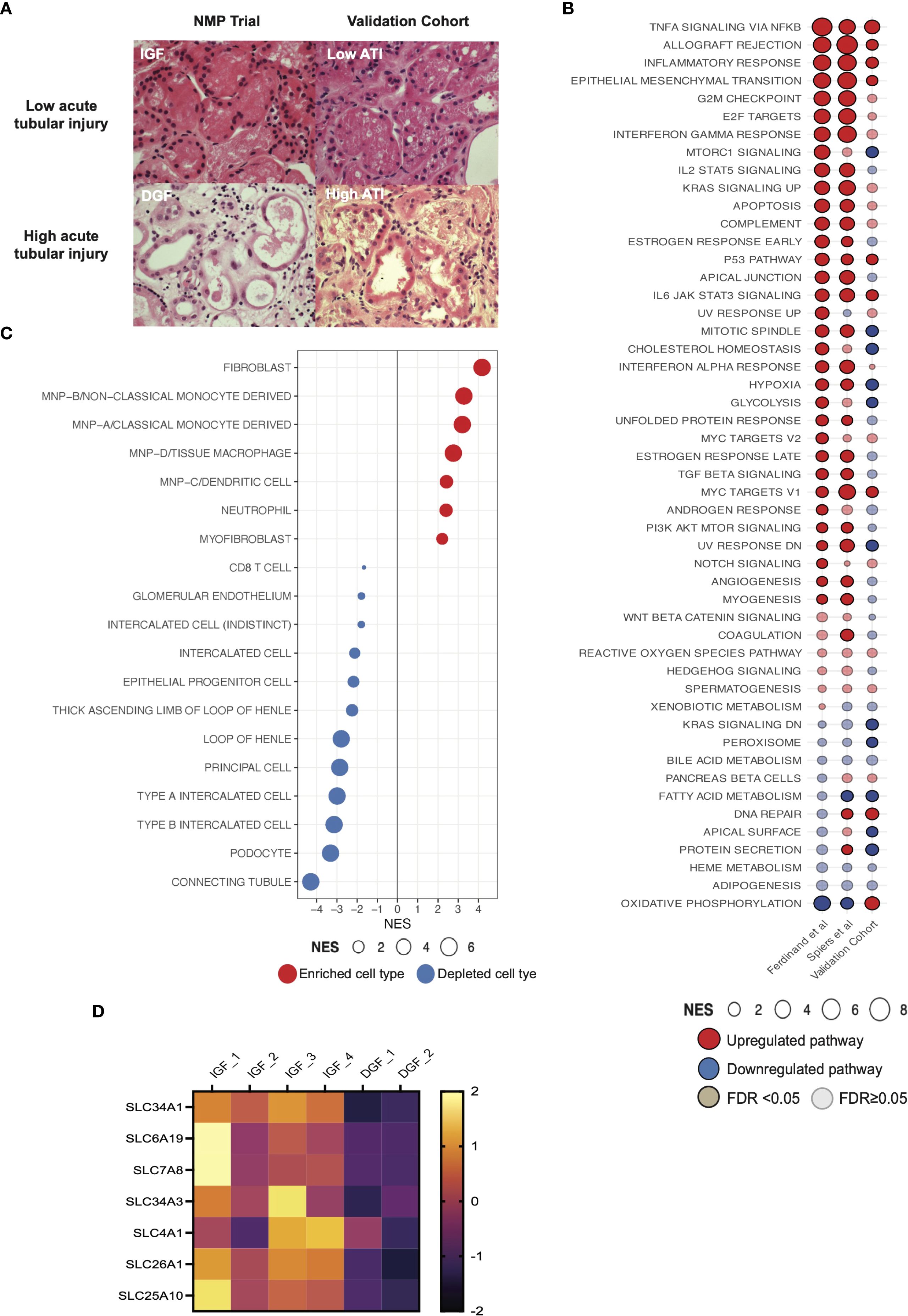Histological slides of kidney biopsies are shown, categorizing tubular injury severity with low and high acute tubular injury (ATI). A dot plot displays enriched and depleted cell types, with fibroblasts and macrophages showing enrichment. A bubble chart illustrates gene pathway activation or repression, highlighting upregulated and downregulated pathways such as TNF-alpha signaling and oxidative phosphorylation. A heatmap presents gene expression profiles for different samples, showing varying expression levels of SLC genes across conditions like IGF and DGF. The charts and images collectively analyze kidney injury mechanisms and cellular responses.