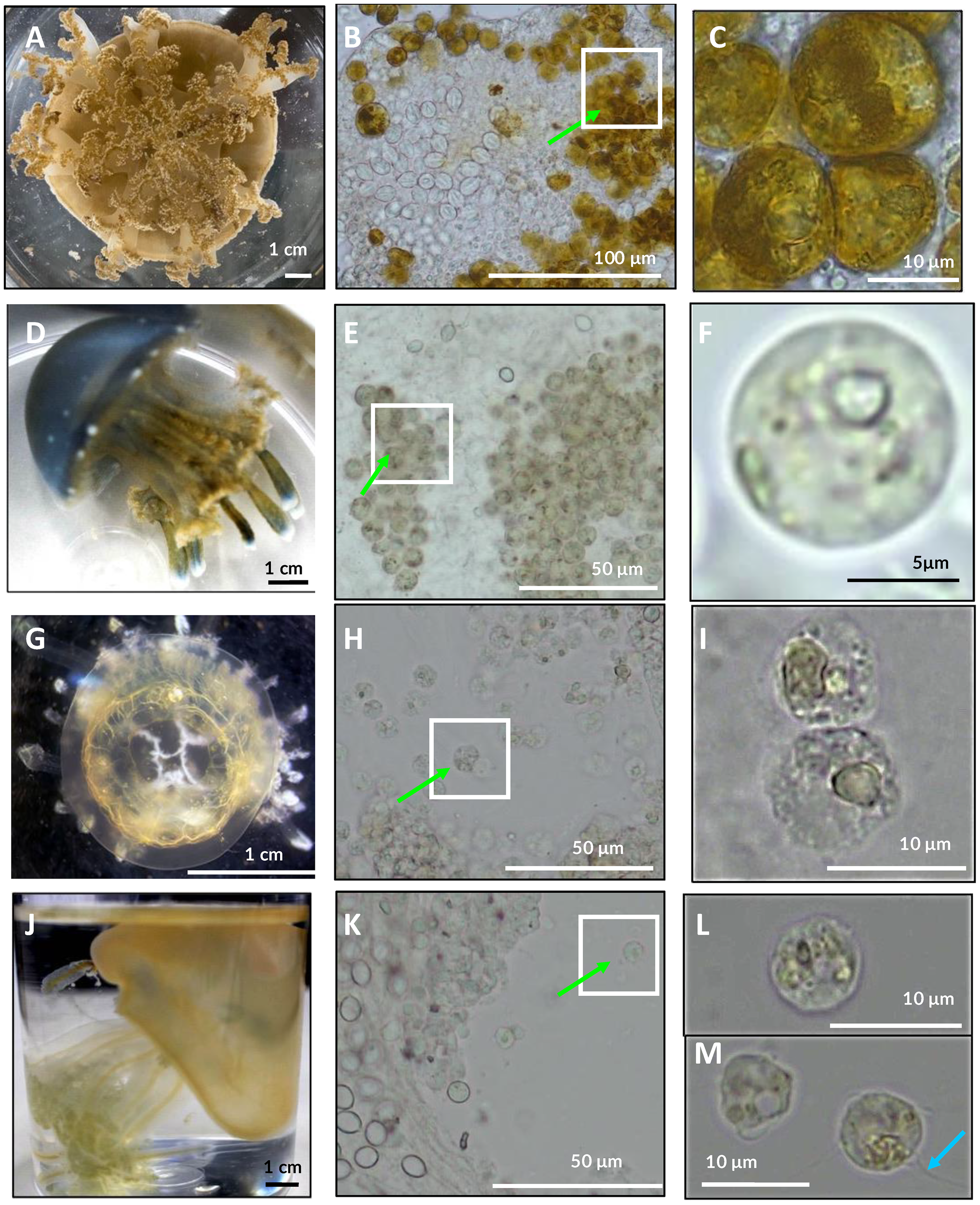 Light microscope images showing tissue sections from several rhizostome jellyfish species. Panels compare different taxa and body regions, highlighting the presence of symbiotic dinoflagellate cells within host tissues. Arrows indicate notable cellular features, including symbiont cells and structures suggesting free-living stages. Scale bars provide size reference.