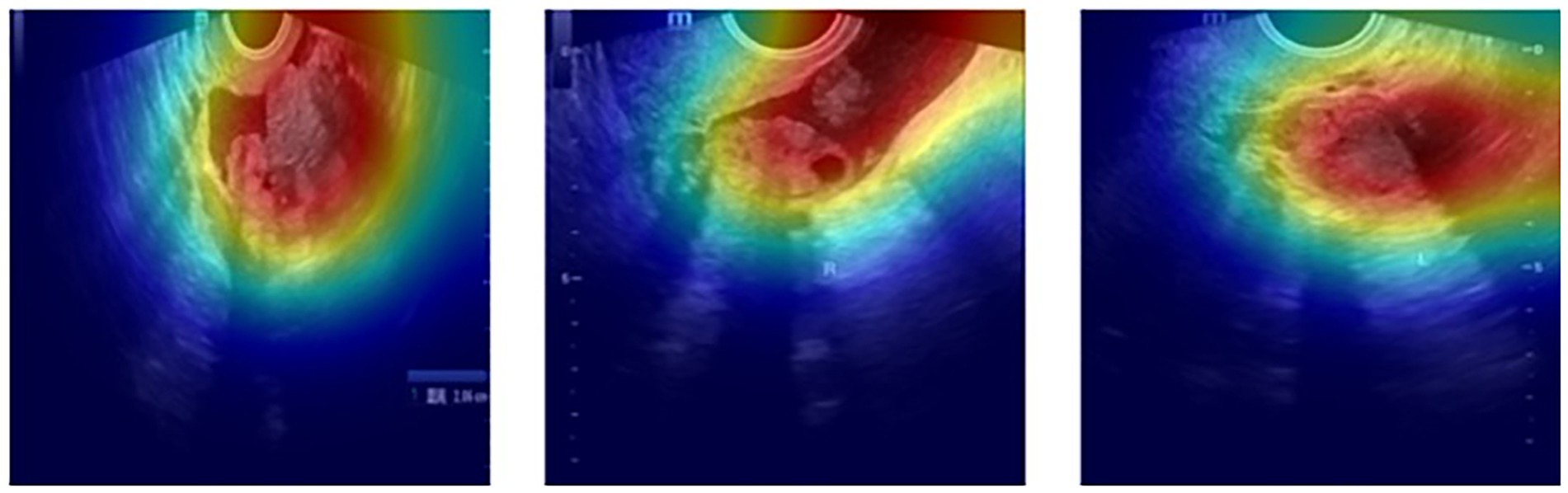 Three ultrasound images display colorful heat maps of a cross-sectional view of a circular structure with varying intensity. The regions transition from red at the center to blue at the edges, indicating different density or composition levels.