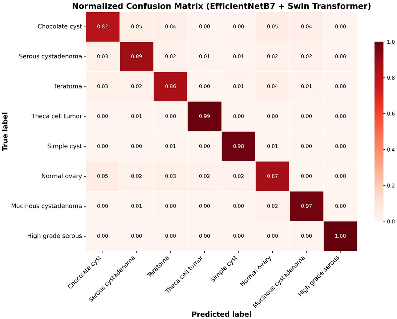 Normalized confusion matrix for EfficientNetB7 and Swin Transformer model. True labels and predicted labels include chocolate cyst, serous cystadenoma, teratoma, and others. Notable values: theca cell tumor at 0.99, high grade serous at 1.00, chocolate cyst at 0.82. The color gradient ranges from light to dark red, indicating increasing accuracy.