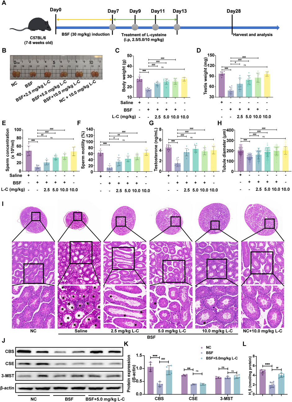 Experimental setup illustrating the effects of different doses of L-cysteine on C57BL/6 mice over 28 days. Images and graphs show sperm concentration, motility, testosterone levels, testis and tubule measurements, and protein expression. Histological slides display testicular tissue at various treatments. Bar graphs provide statistical analysis of changes in body weight, testis weight, and hormonal levels across different conditions. Immunoblot results for proteins CBS, CSE, and 3-MST are shown, highlighting differences in expression in response to treatments.