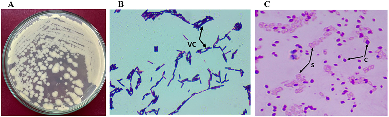 Panel A shows a petri dish with white bacterial colonies on an agar surface. Panel B is a microscopic image of rod-shaped bacteria labeled “VC” and “C”, indicating variable chain formations. Panel C is a microscopic image of cocci and short rods labeled “S” and “C”, representing different bacterial shapes and arrangements.