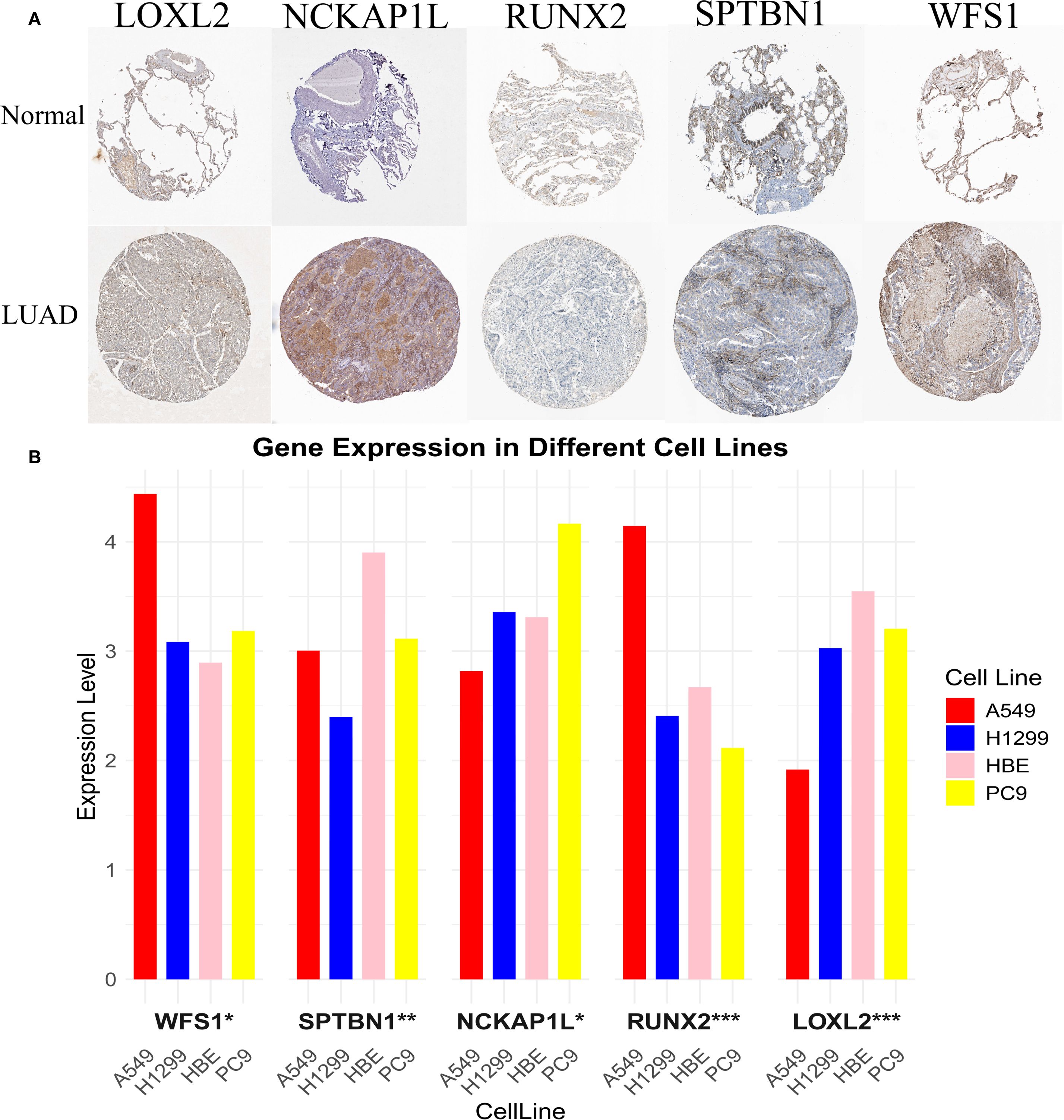 Panel A displays tissue samples stained for LOXL2, NCKAP1L, RUNX2, SPTBN1, and WFS1 from normal and LUAD tissues, highlighting differences in expression patterns. Panel B is a bar chart illustrating gene expression levels in different cell lines (A549, H1299, HBE, PC9), with variation seen across each gene: WFS1, SPTBN1, NCKAP1L, RUNX2, and LOXL2. Each cell line is color-coded for clarity.