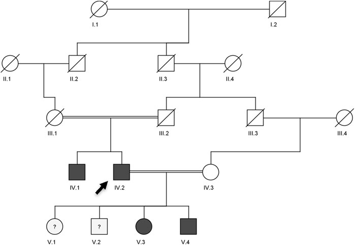 A family pedigree chart showing multiple generations. Squares represent males and circles represent females. Shaded shapes indicate affected individuals. Each generation is labeled with Roman numerals. Individuals are marked with Arabic numerals. Some individuals have a diagonal line, indicating deceased status. A question mark inside a shape suggests uncertain status. A black arrow points to individual IV.2, who is shaded.