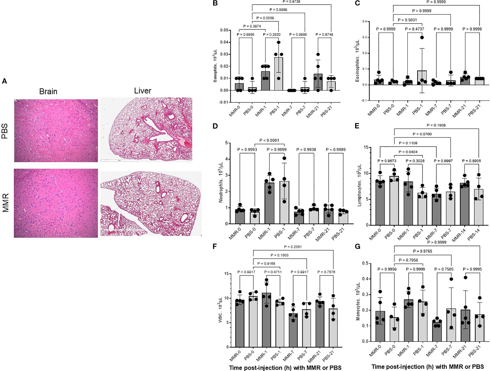 Histological and graphical analysis of brain and liver tissues in mice treated with PBS versus MMR, alongside blood cell count comparisons. Panel A shows microscopic images of brain (left) and liver (right) tissues, with noticeable differences in structure. Graphs B to G display various blood cell counts: basophils, eosinophils, neutrophils, lymphocytes, white blood cells, and monocytes, labeled with mean and error bars, comparing PBS and MMR treatment groups at different time points. Statistical significance is indicated with p-values for each graph, highlighting differences between treated groups over time.