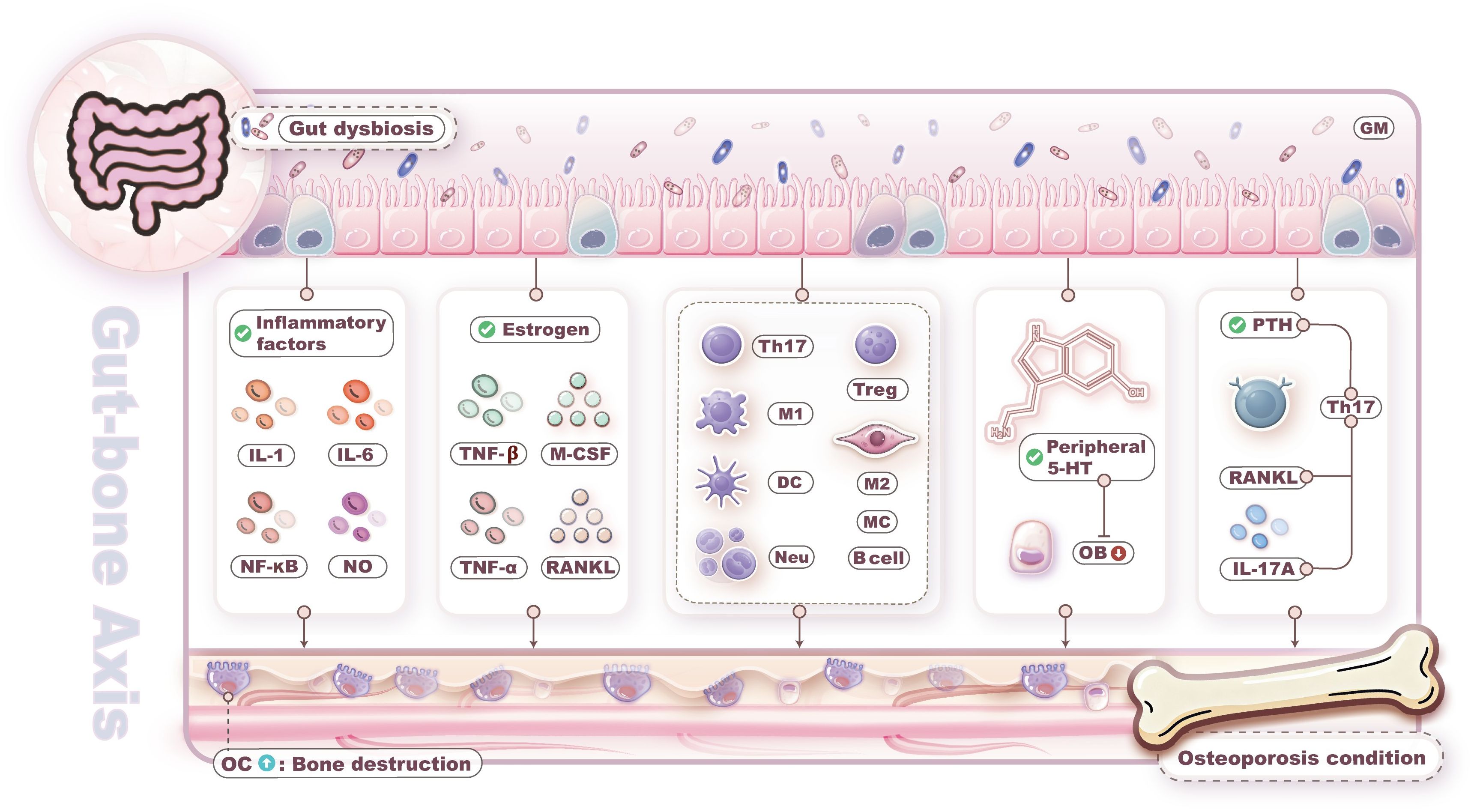 Diagram illustrating the gut-bone axis, highlighting the impact of gut dysbiosis on bone health. It includes various factors like inflammatory markers (IL-1, IL-6, NF-κB), estrogen, PTH, and peripheral serotonin. These factors influence cells like Th17, Treg, and osteoclasts, relating to osteoporosis conditions. The diagram emphasizes interactions between the gut microbiota and bone destruction.