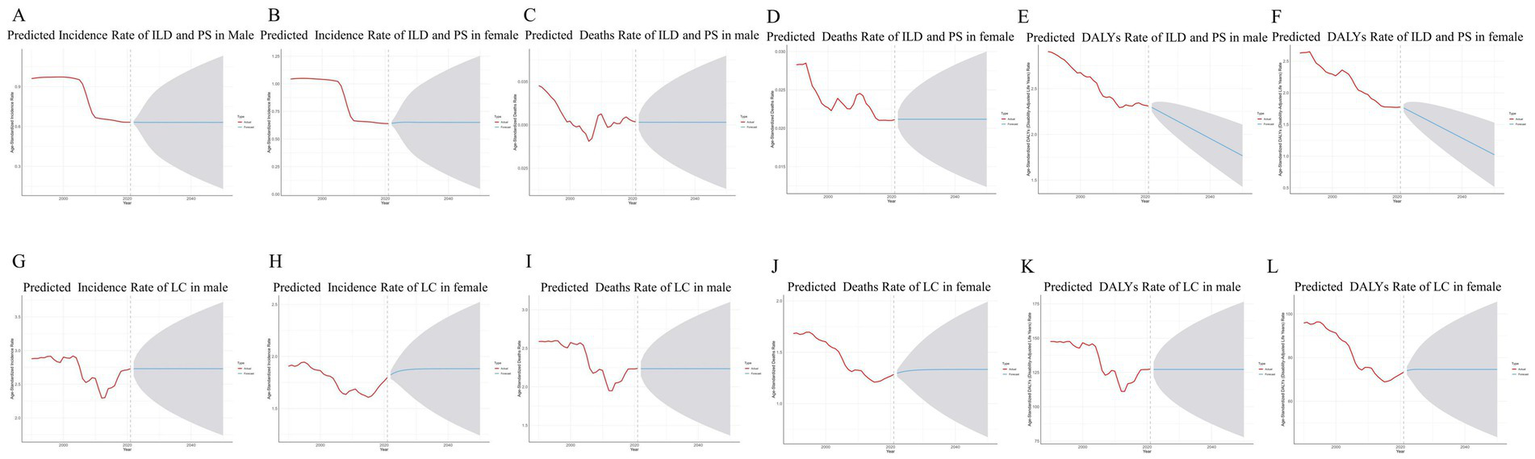 Twelve graphs show predicted rates for ILD and PS Lung cancer in males and females. Each graph includes a red line for actual data and a blue line for predictive data. ILD graphs (A-F) cover incidence, death, and DALYs. LC graphs (G-L) include the same categories. The x-axis is time, and the y-axis varies by graph type. Shaded areas indicate prediction intervals.