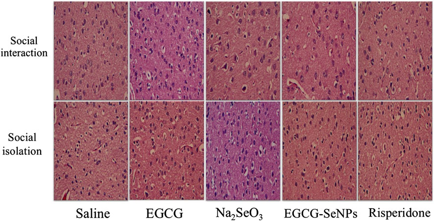 Histological brain tissue images in two rows labeled