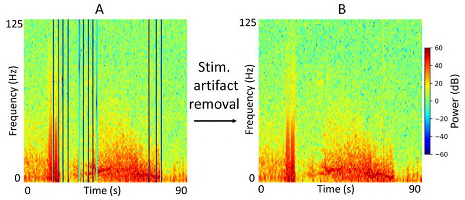 Spectrogram comparison showing frequency over time from 0 to 90 seconds. Panel A has vertical black lines indicating stimulus artifacts. Panel B shows the same data with artifacts removed. The color scale on the right represents power in decibels from blue (-60 dB) to red (60 dB).