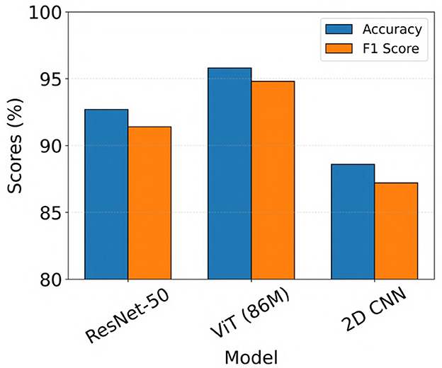Bar chart comparing accuracy and F1 score for three models: ResNet-50, ViT (86M), and 2D CNN. ResNet-50 shows about 92% accuracy and 91% F1 score. ViT (86M) has approximately 96% accuracy and 95% F1 score. 2D CNN shows around 87% accuracy and 86% F1 score.