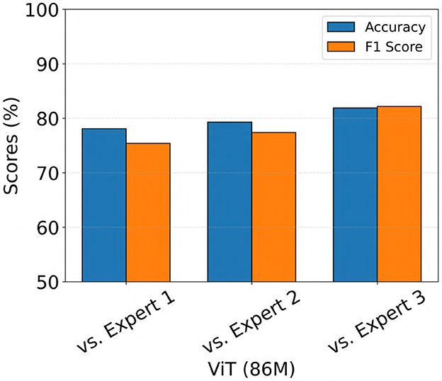 Bar chart comparing the accuracy and F1 score of ViT (86M) against three experts. Scores for Expert 1 are approximately 78% accuracy and 73% F1 score. Expert 2 and Expert 3 both show similar values around 80% for both metrics.