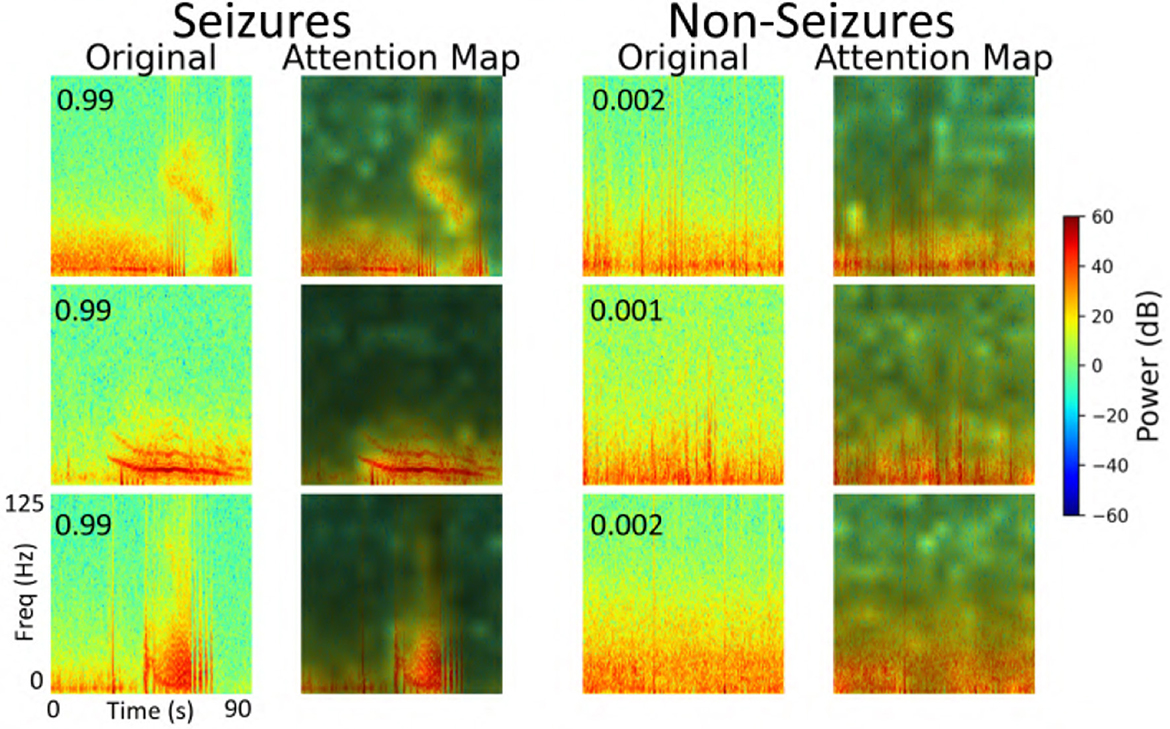 Spectrogram comparisons for seizure and non-seizure events. The left section shows three original spectrograms with high prediction scores for seizures, alongside their attention maps. The right section displays spectrograms with low prediction scores for non-seizures, also with attention maps. Both sections use a color scale indicating power levels from blue to red.