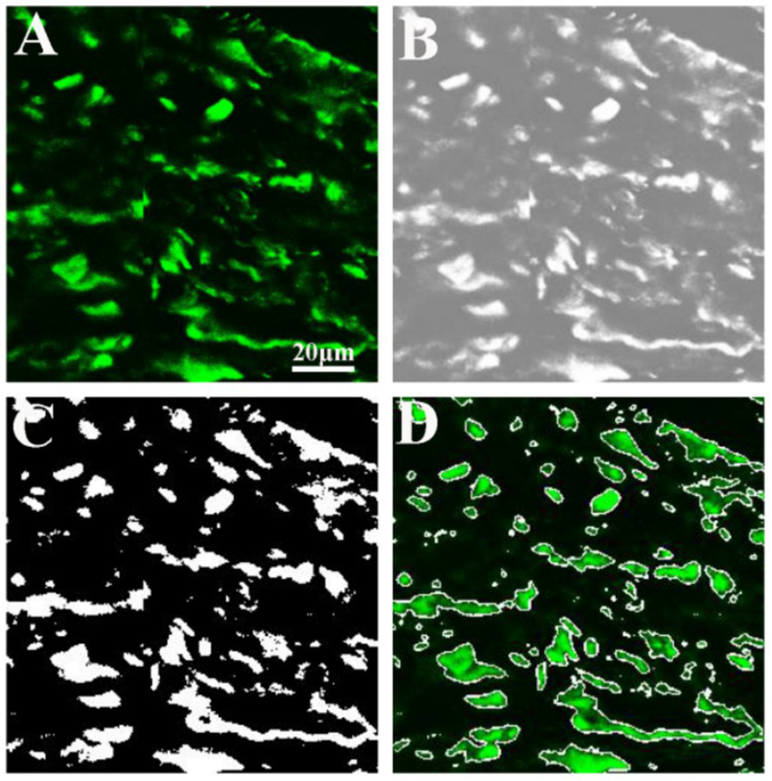 Four-panel image showing fluorescence microscopy analysis. Panel A: Green fluorescent collagen fibers on a dark background. Panel B: Grayscale version of Panel A. Panel C: Black and white thresholded image of Panel A. Panel D: Green fluorescent fibers outlined on a dark background, showing the final segmentation. Scale bar is 20 micrometers.
